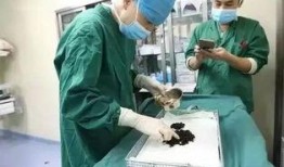 医生爆料结石视频大全,结石病痛真相，视频大全揭示结石成因与防治方法